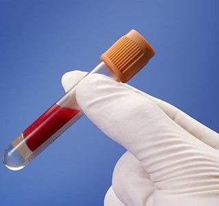 糖尿病人糖化血红蛋白总是大于6.5，并发症发生可能性会很大吗？