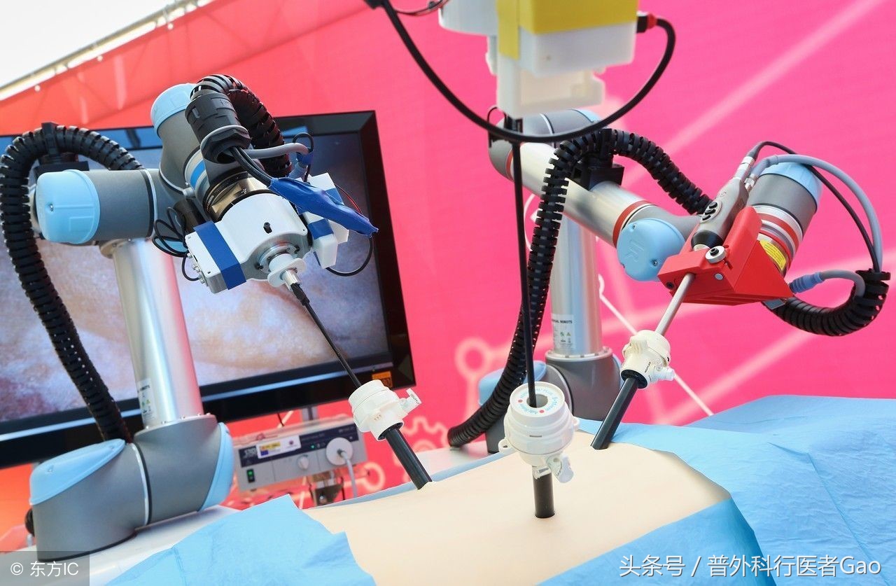 鏉忎粊鑳芥不闃戝熬鐐庡悧,鏉忎粊鍒囬櫎