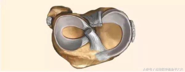 盘状半月板撕裂缝了3针,半月板撕裂应该避免做哪些动作