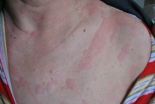 哪些症状反映胎宝宝很健康,孕晚期胎宝宝的求救信号