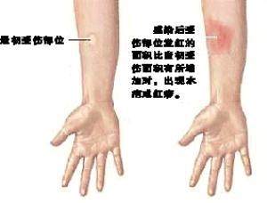 被猫抓狂犬病前兆有什么特征,被猫抓狂犬病早期的10个征兆