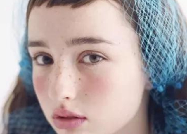 激光祛痣留下坑会长平吗,激光祛痣的疤痕会消失吗