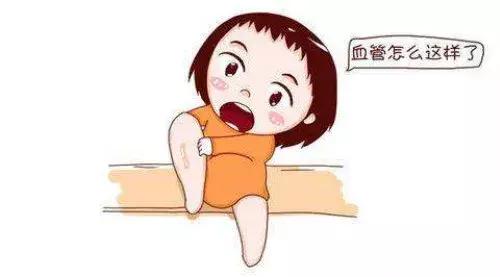 静脉曲张孕期需要注意什么,孕期打静脉曲张的针