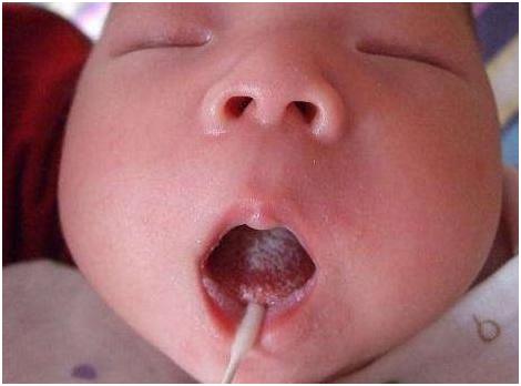 抗生素不能一起吃的食物,抗生素不能滥用激素也不能乱用