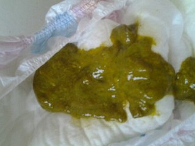 根据宝宝便便形状判断便秘,如何根据便便判断宝宝是否拉肚子