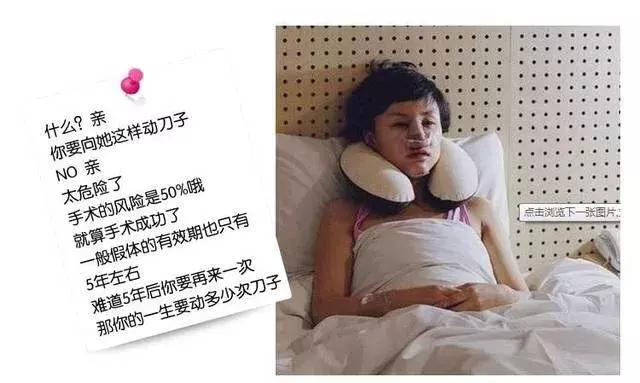 整形“神器”大测评：传说中的隆鼻夹真的靠谱吗？