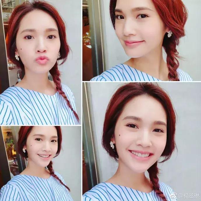 触目惊心！杨丞琳阿娇等人把刮痧过度神话，专家打脸：根本没效果