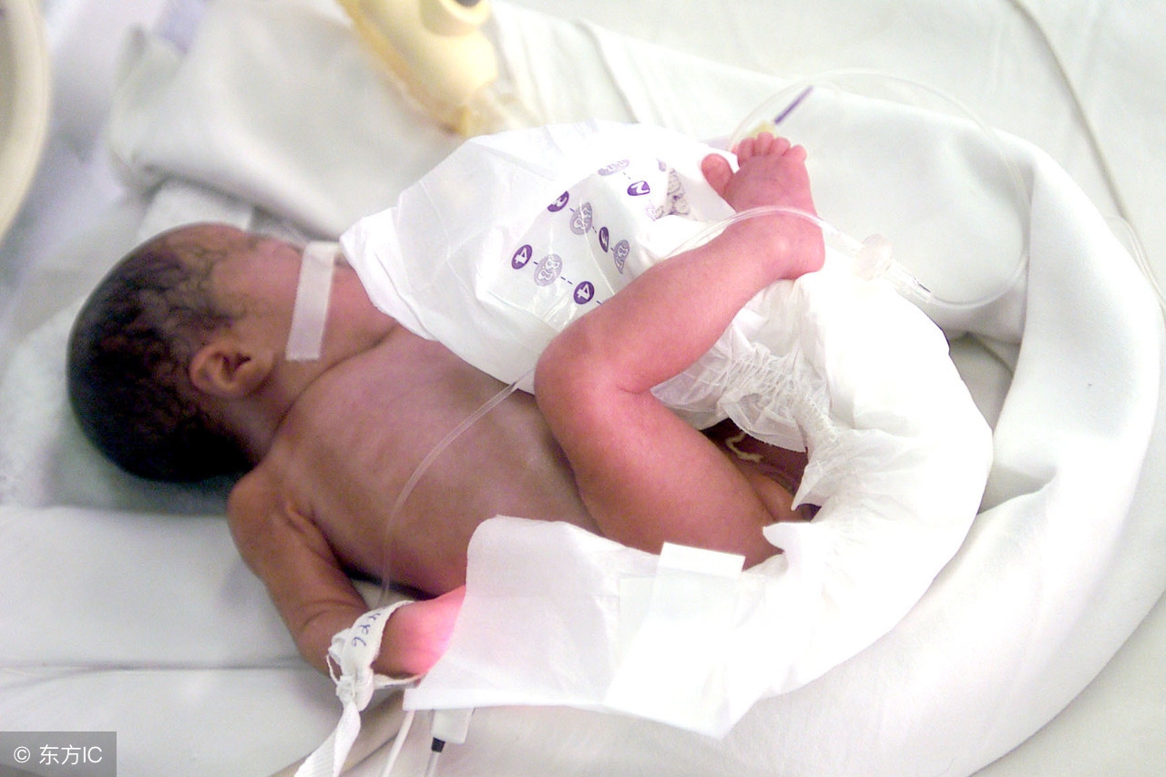 预防早产儿妈妈需注意4件事,导致早产儿的原因是什么