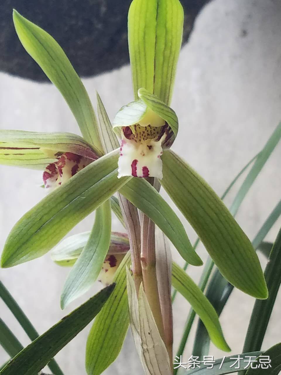 生理性焦虑原因,生理性恐惧怎么克服