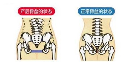 产后必需尽快恢复的两个部位，很多女人产后身体不好，就是因为它