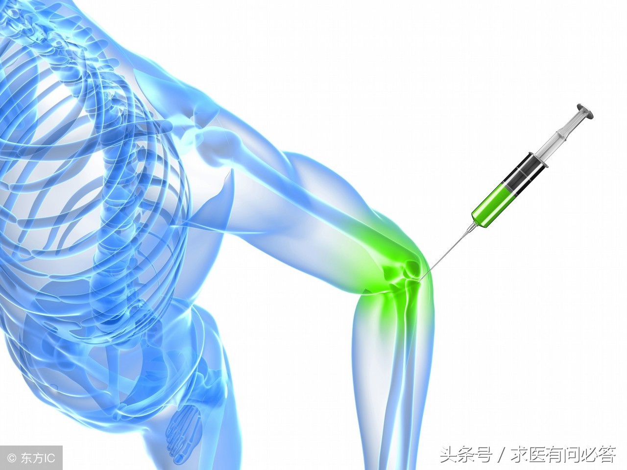 绒毛结节性滑膜炎饮食注意事项,痛风和滑膜炎饮食上应注意什么