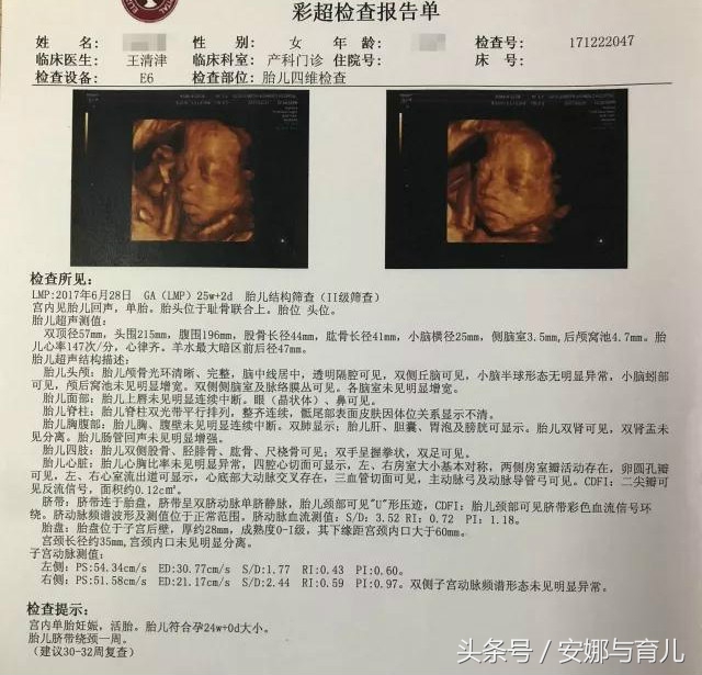 四维彩超那么贵胎宝不配合咋办,做四维胎宝宝一直不配合