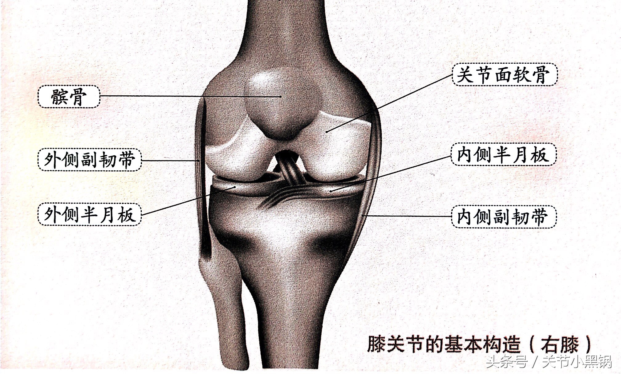 关节镜微创手术适应症有哪些,微创手术和关节镜有什么区别