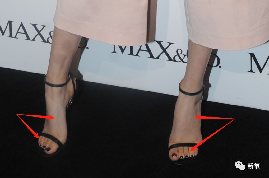 孙怡涂粉,孙怡裹腿美白大法