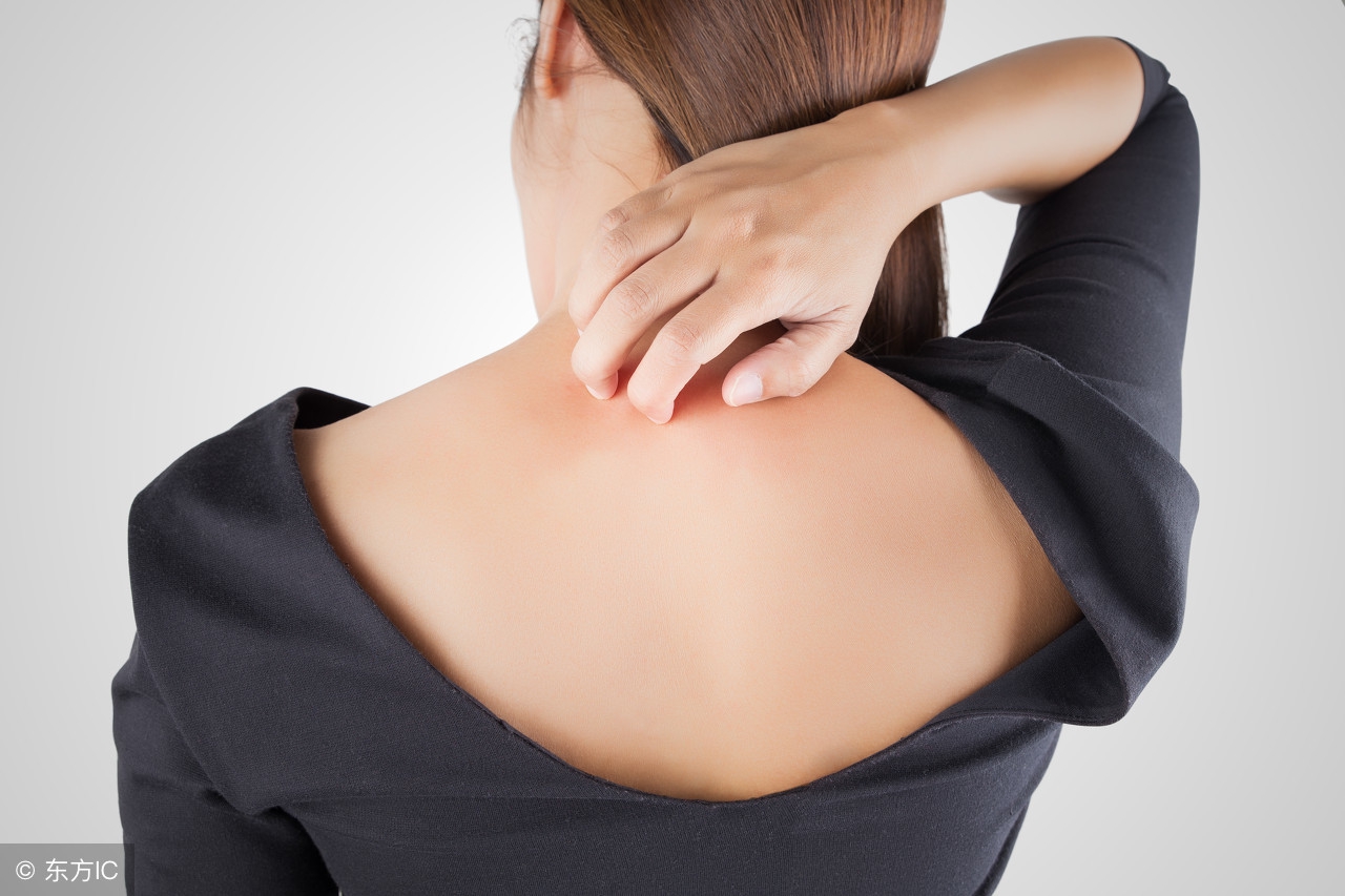 大人预防痱子最有效的方法,治痱子的7个好方法