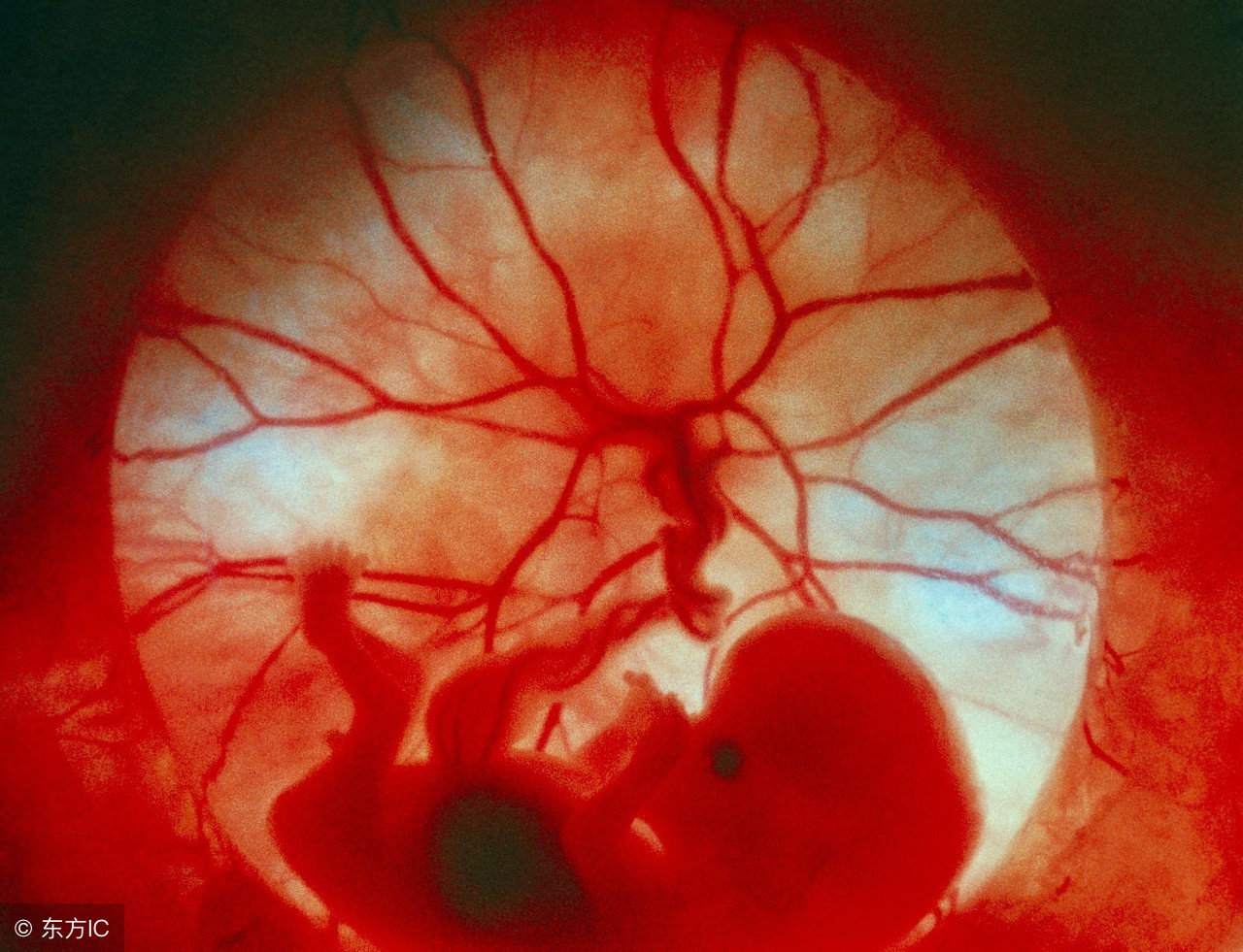 孕18周孕吐是怎么回事,孕18周了还有孕吐