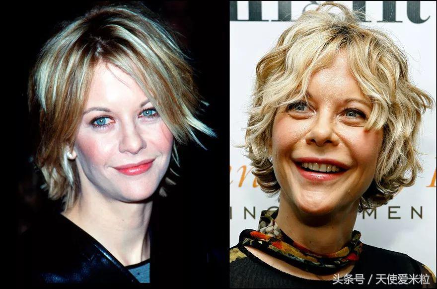 最新的整形塑形手术,7种整形手术可以尝试