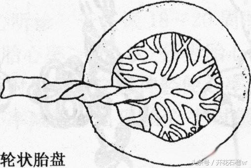 四维查出完全前置胎盘,四维有强光点和轮状胎盘
