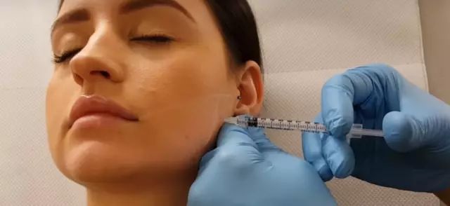 瘦脸针真有那么神奇吗,瘦脸针bbc