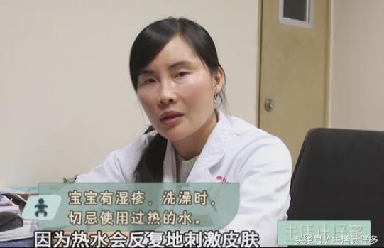 宝宝反复湿疹对付湿疹有妙招,宝宝湿疹反反复复的最佳治疗方法