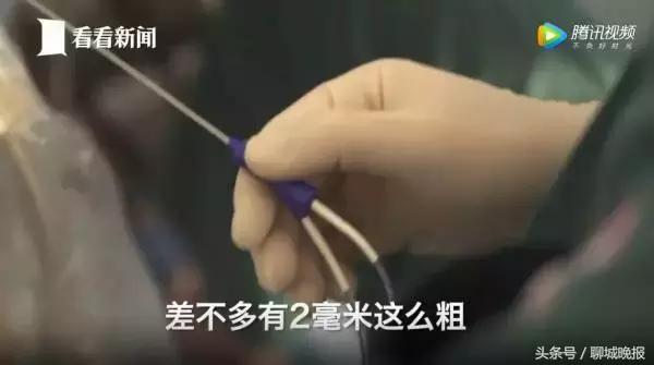 18岁姑娘多次捐卵致生命垂危,女学生捐卵新闻