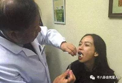 高圆圆戴牙套的脸型变化图,高圆圆戴牙套前后对比照