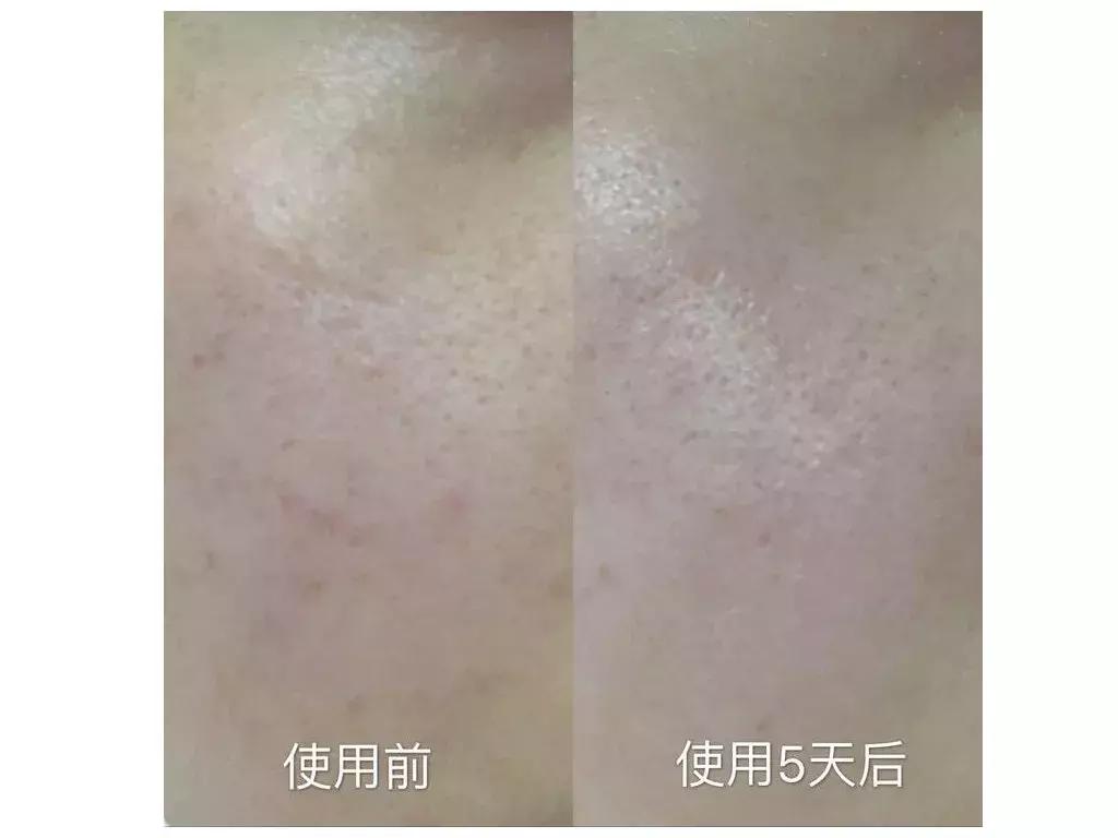 cosme精华推荐,cosme补水精华