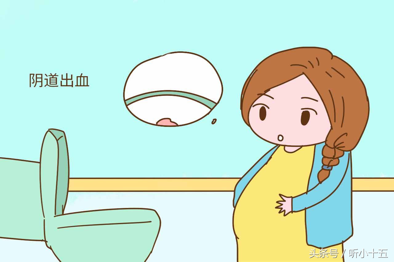怀孕阴道出血会有什么症状,怀孕流血像来月经一样是流产了吗
