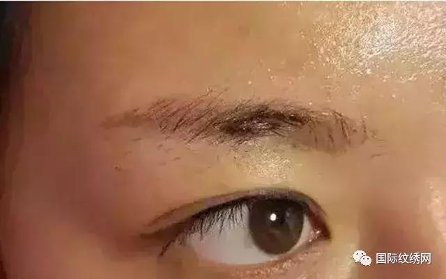 半永久眉失败了怎么办,半永久眉毛眉形不好怎么办