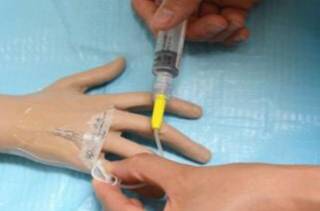 为什么留置针封管后会有回血现象,为什么留置针通畅不鼓包但是疼