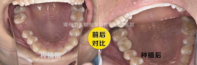 一问一答口腔科普视频,一问一答正畸