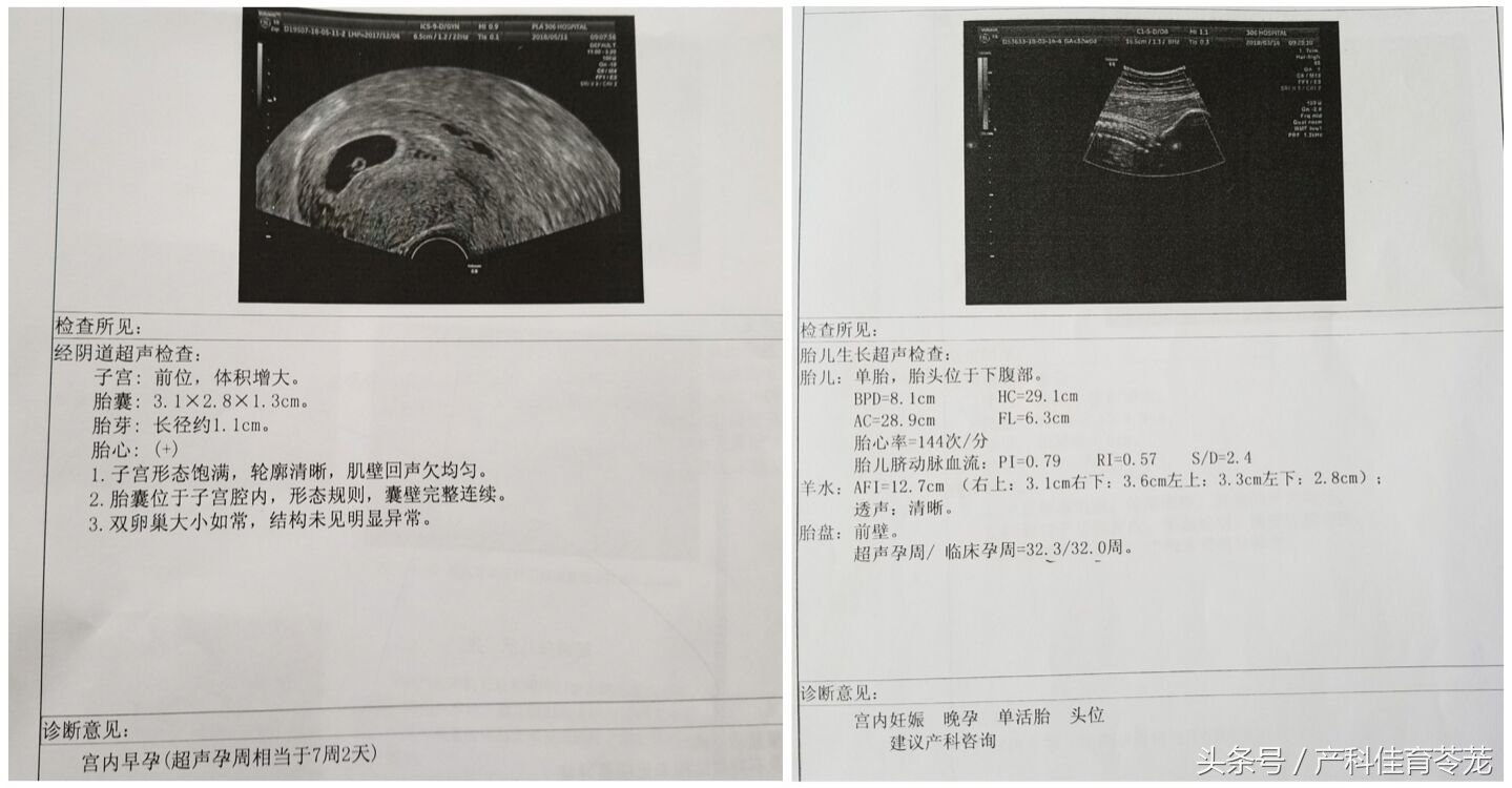 如何看懂乳腺超声检查报告,怎么能让临床医生看懂超声报告