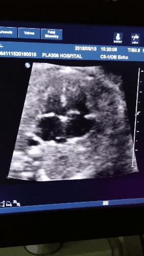 b超的3组数字代表什么,b超图片上的数字