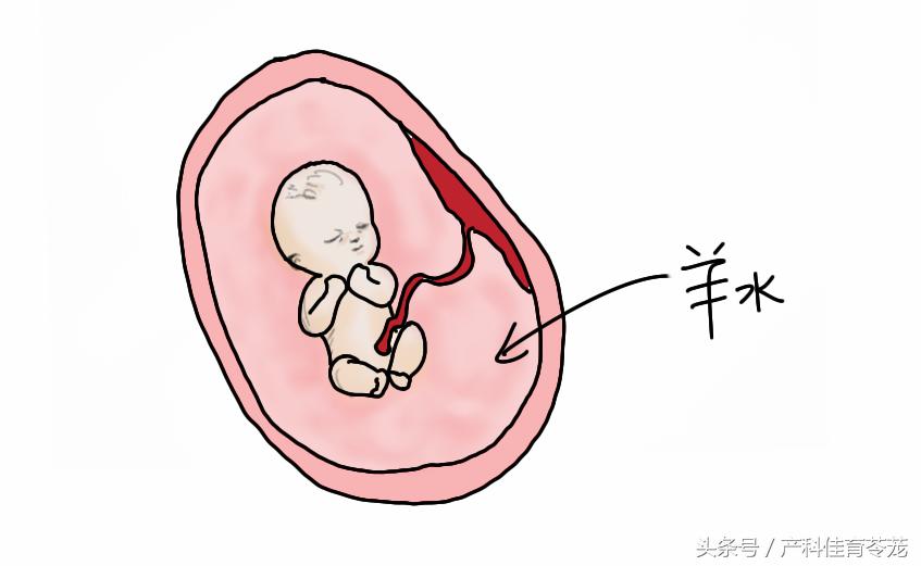 如何看懂乳腺超声检查报告,怎么能让临床医生看懂超声报告
