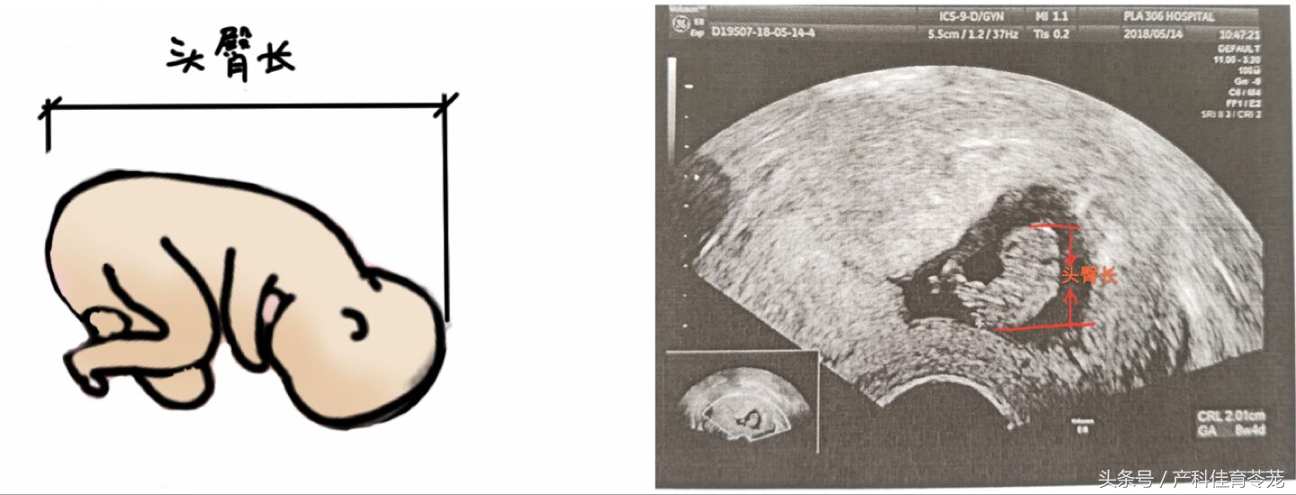 孕期B超数据准确吗,b超医生说的数字