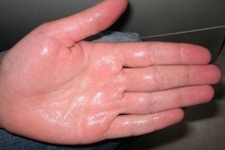 总爱出汗什么意思,容易出汗而且出汗量多是什么原因