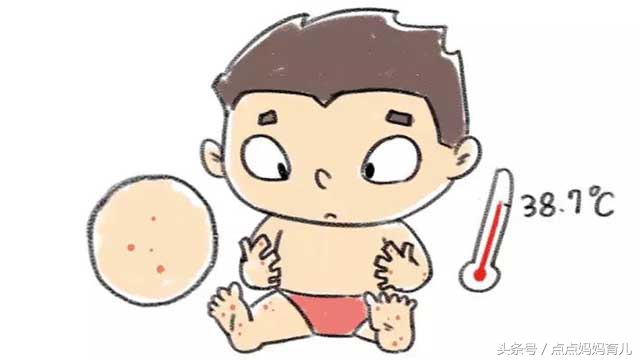 孩子水痘妈妈怎么预防,科普如何正确应对水痘高发季