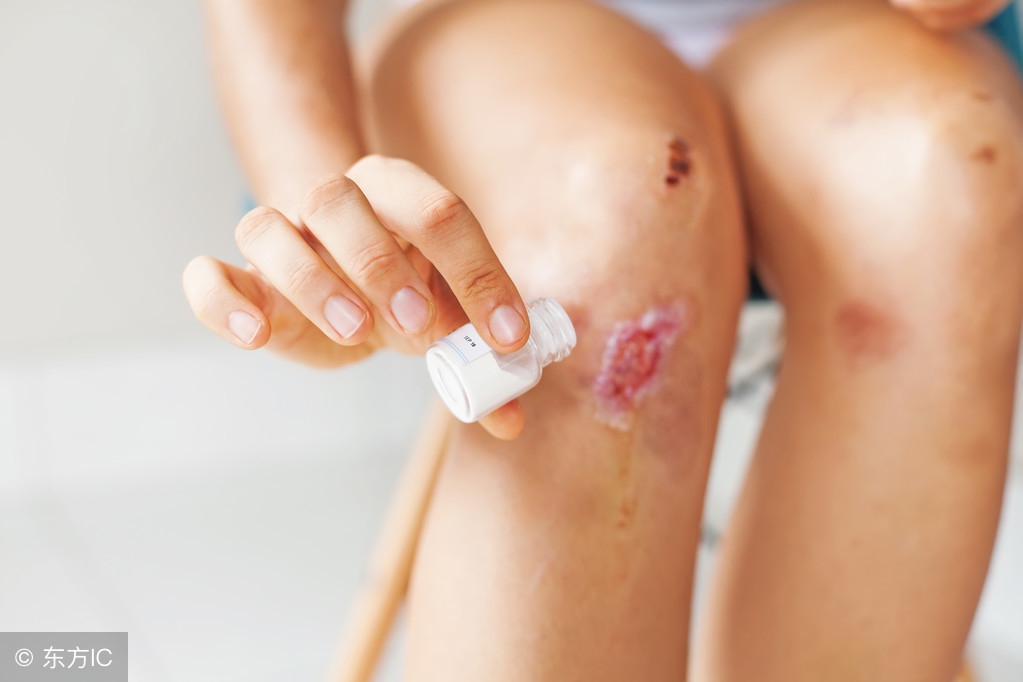 受伤了留疤了怎样消除疤痕,受伤后如何护理才能避免留疤