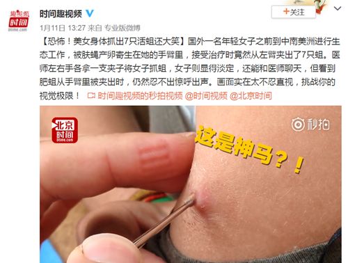 吃小龙虾从身体上取出虫子视频,女子体内取出一米虫子后续