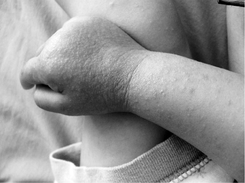 小孩玩沙生病,小孩玩沙怎么引导