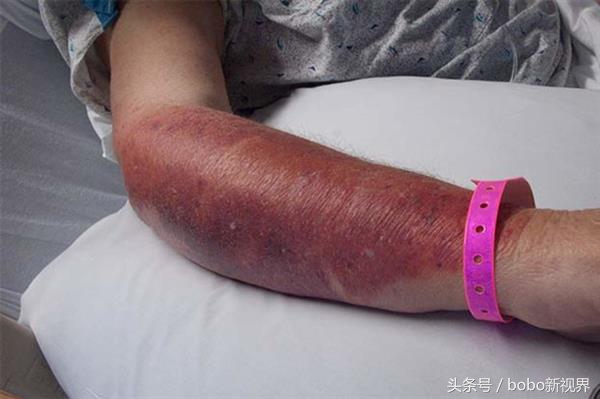 也许你还不知道，你整天拿在手里的手机已经成为了病菌聚集地