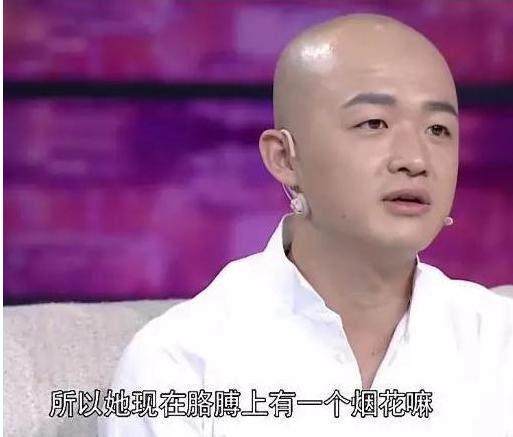 高晓松烟疤,高晓松烫烟疤