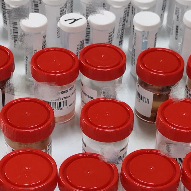 病理报告为什么不能确诊,病理报告为啥什么也没写