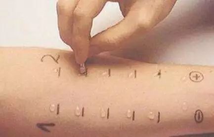 孕妈鼻炎发作怎么办,孕妇鼻炎胎儿会缺氧吗