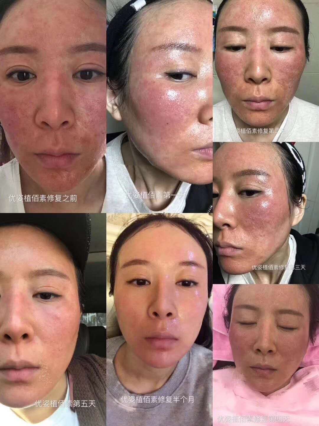 植佰素产品视频,植佰素护肤品怎么样