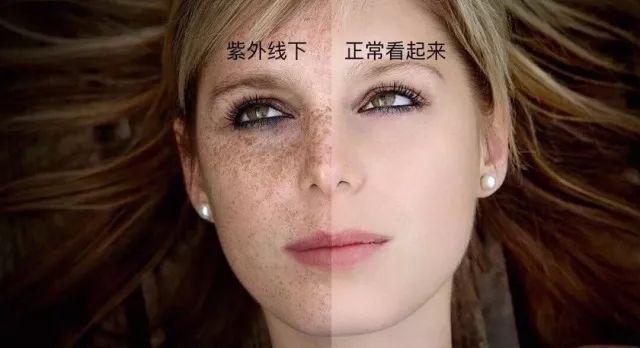 夏季皮肤病护肤,皮肤科医生教你夏季护肤