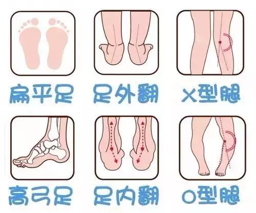 宝宝穿什么凉鞋对脚好,适合走路内八字宝宝穿的凉鞋