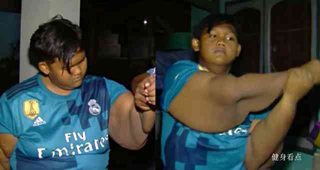 还记得那位400斤的印尼少年吗？这是他减肥1年半后的样子！