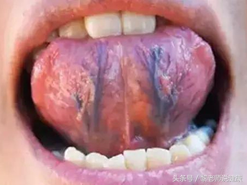 青筋很明显意味着什么,青筋凸起真的有人手会青筋暴起吗