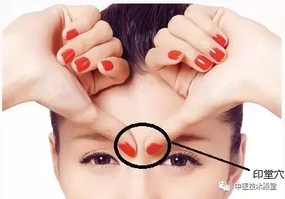 头痛用手揪一揪,头痛揪痧揪眉心就不痛是什么原因